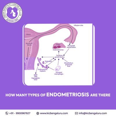 How many types of endometriosis are there